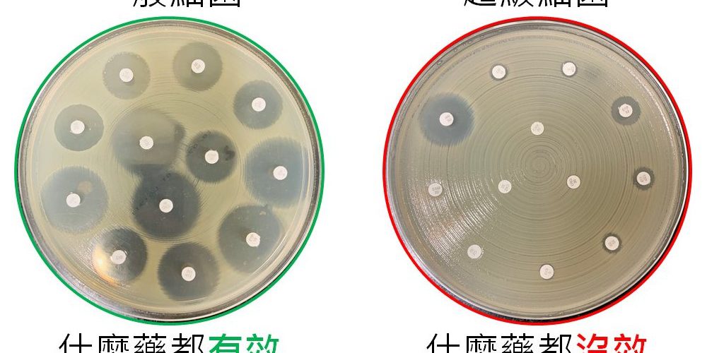 超級細菌異軍突起　AI預測模型潛力無窮